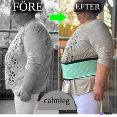 Calmleg-Den Kompletta Höft - Och Nedre Delen Av Ryggen För Enklare Promenader Och Stående - Calmleg