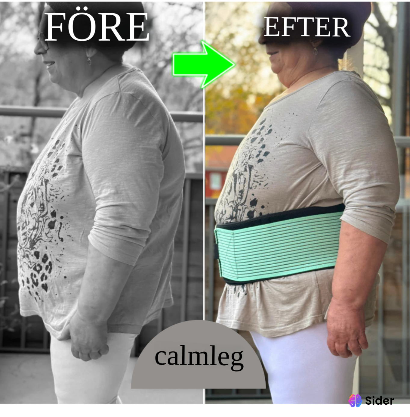 Calmleg-Den Kompletta Höft - Och Nedre Delen Av Ryggen För Enklare Promenader Och Stående - Calmleg